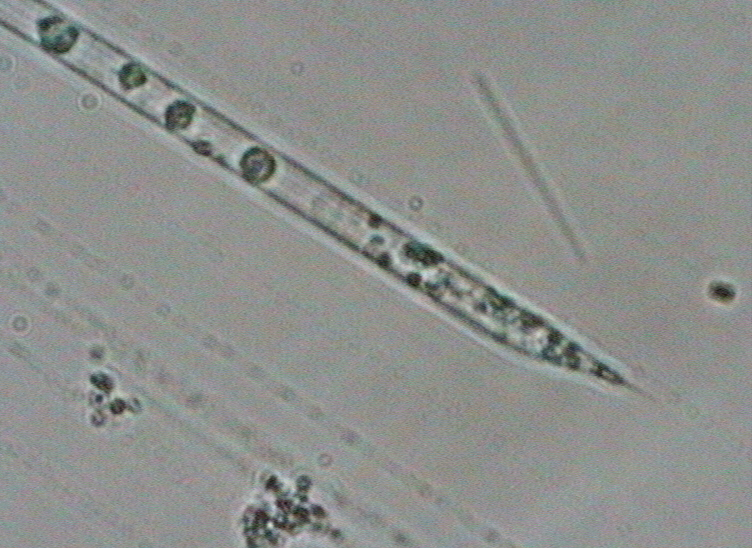 Dictyocha speculum